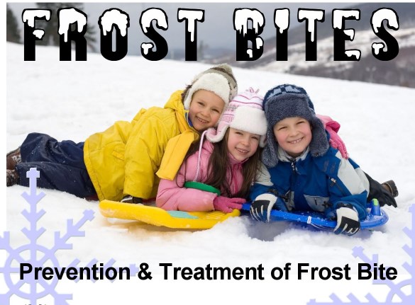 Frostbite